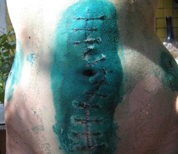 №1, Игнатий Йитанги, Псков №1, Игнатий Йитанги, Псков