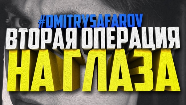 ЭТОЯСЕГОДНЯ, Косоглазие. Вторая операция на